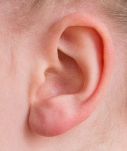 Auriculoterapia para bajar de peso en cuanto tiempo se